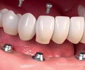 Paramount Dental Sydney