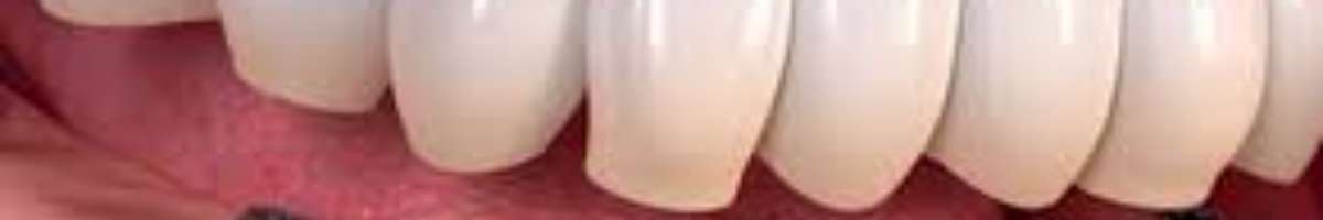 Paramount Dental Sydney Banner