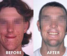 Illawarra Oral and Maxillofacial Surgery