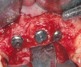 Illawarra Oral and Maxillofacial Surgery