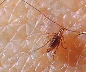 Flea Pest control Perth