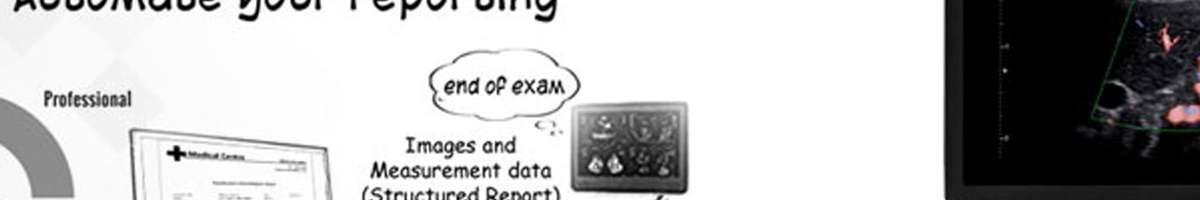 Echocardiography Software – Tempo Healthcare Banner