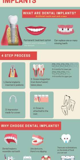 My Gentle Dentist @Arana Hills