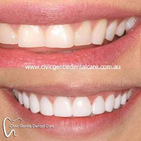 Civic Gentle Dental Care