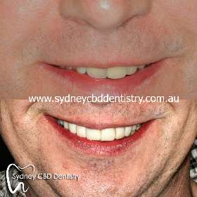 Sydney CBD Dentistry