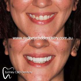 Sydney CBD Dentistry