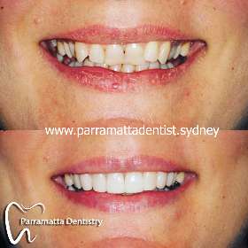 Parramatta Dentistry