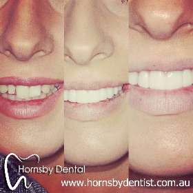 Hornsby Dental