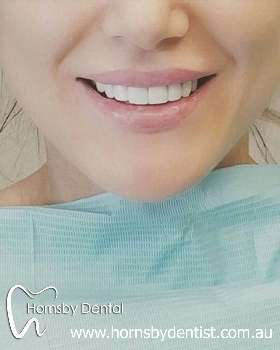 Hornsby Dental