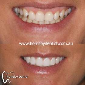 Hornsby Dental