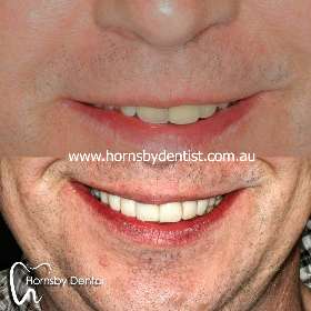 Hornsby Dental