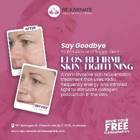 Elos Refirme Skin Lightening | Rejuvenate Wellness Centre