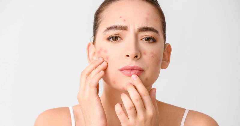 Effective Laser Acne Treatment at Rejuvenate Wellness Centre