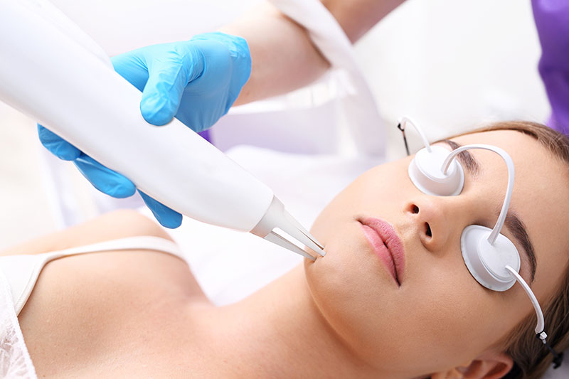 Clear Your Skin with Elos Technology: The Fast and Effective Acne Treatment