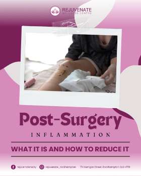 Post-Surgery Inflammation