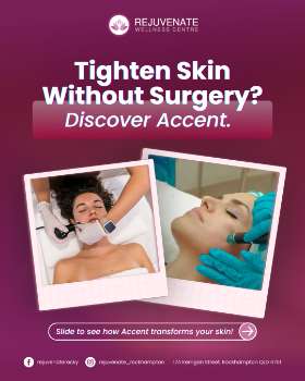 Tighten Skin Without Surgery? Yes, Please!