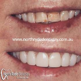 North Ryde Dentistry