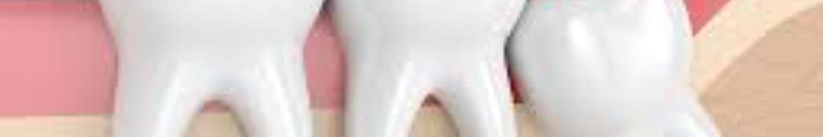 My Wisdom Tooth Dentist Banner