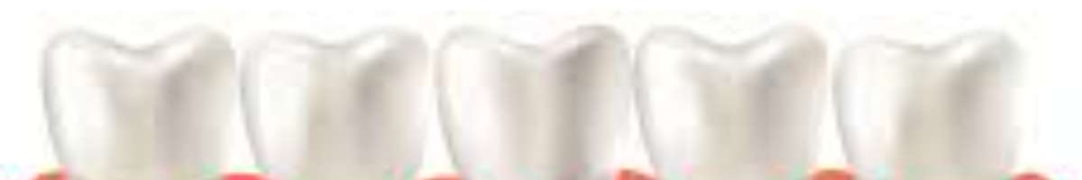 My Implant Dentist - Dentist South Perth Banner