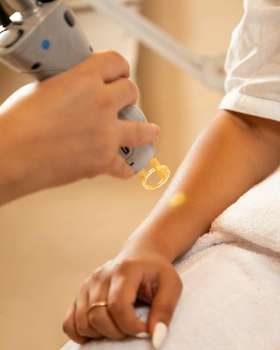 Laser Hair Removal - Cica Skin Care