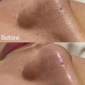Cica Skin Care