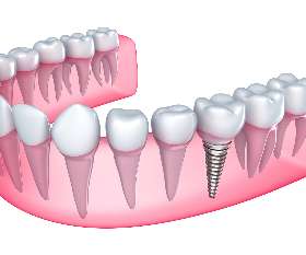 Hawthorn East Dental: Dentists in Melbourne, Hawthorn, Camberwell