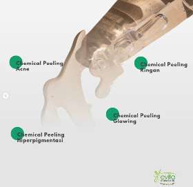 Macam macam chemical peeling | Evita Skin Care