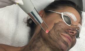 Black Doll Treatment