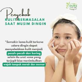 Penyebab kulit bermasalah saat musim dingin | Evita Skin Care