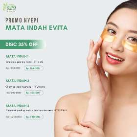 Promo Nyepi Mata Indah Evita