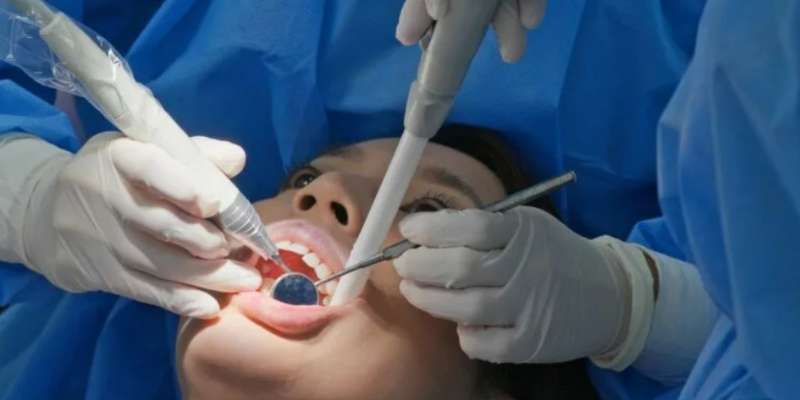 Root Canal Treatment Parramatta