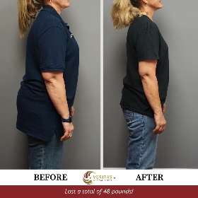 Weight loss total: 48 pounds | Veritas Medical Center