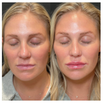 What Are Injectables?