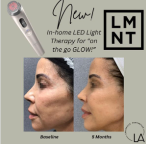 Your At-Home Glow Solution from Louisville Aesthetics
