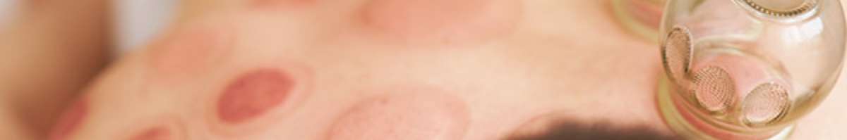 Cura Acupuncture & Herbs Banner