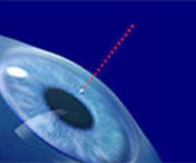 Perfect Vision Optical