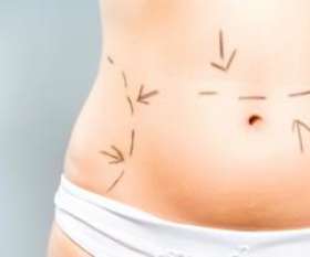 Dr Robert Goldman Cosmetic Surgeon