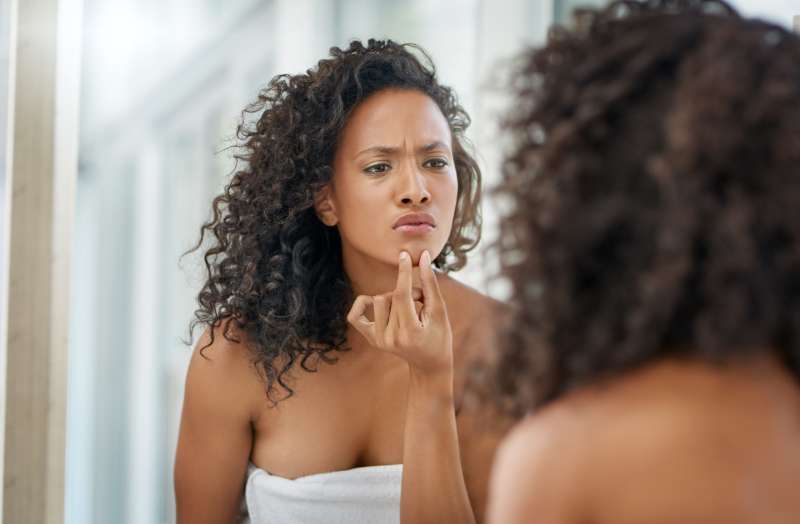 Why Your Skin Keeps Breaking Out Even When You're Doing Everything Right