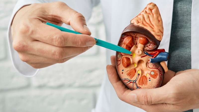 Kidney Stones Treatment: What I Tell My Patients