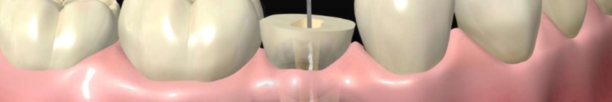 BALSAM DENTAL Banner