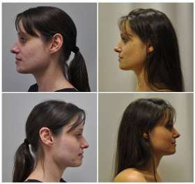 Australia Plastic Surgery