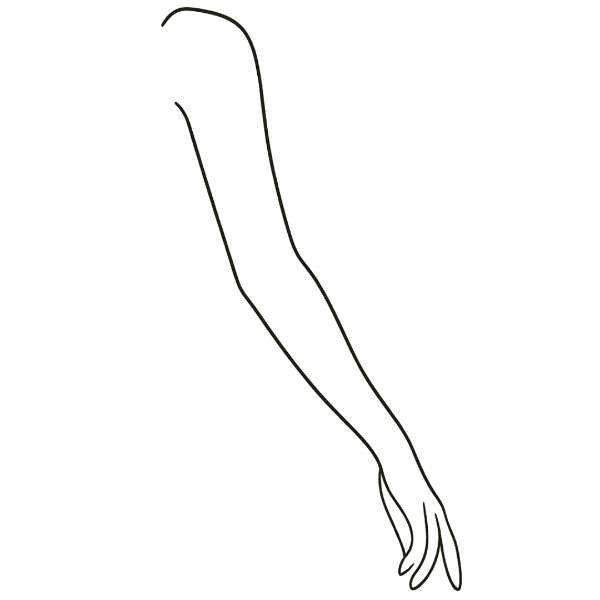 Arm Lift