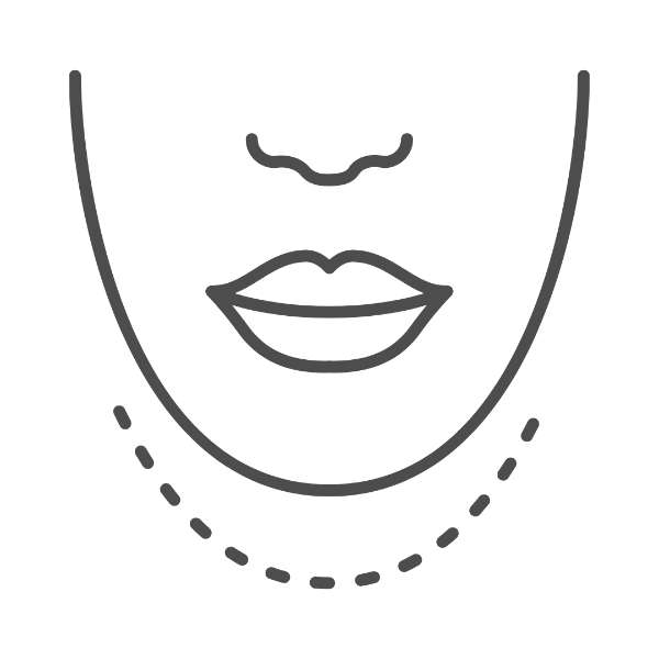 Chin Augmentation (Chin Implants)