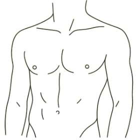 Male Breast Reduction – Gynaecomastia