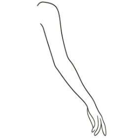 Arm Lift