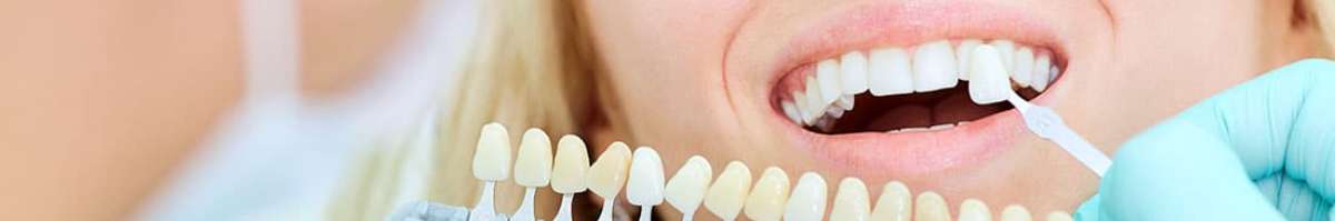 Moorooka Dental Care Banner