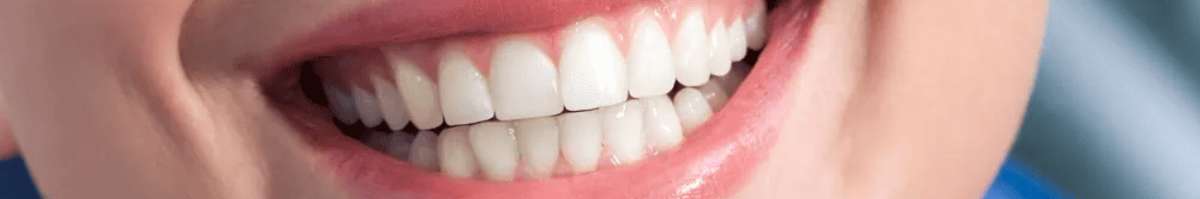 Dental implants Melbourne | My implant Dentist Banner