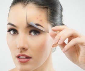 How to Get Rid of Acne