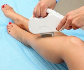 Laser Hair Removal: How It Works