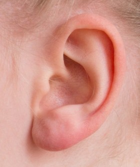 All You Need to Know About Otoplasty
